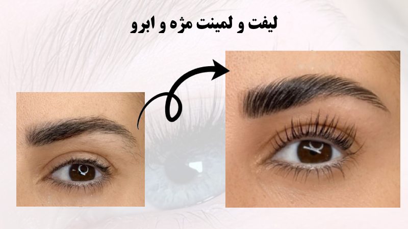 لیفت و لمینت مژه و ابرو